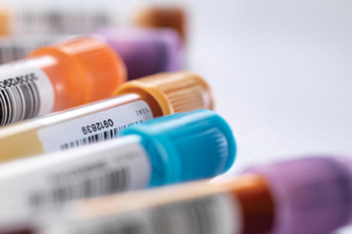 Clinical samples.jpg