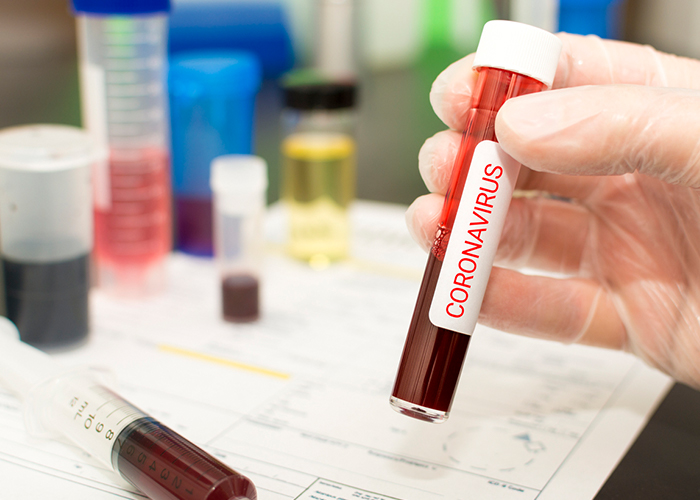 coronavirus.jpg