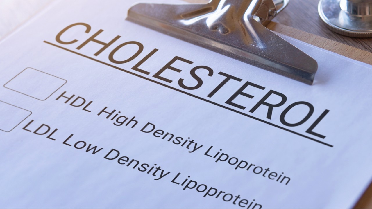 cholesterol-1280