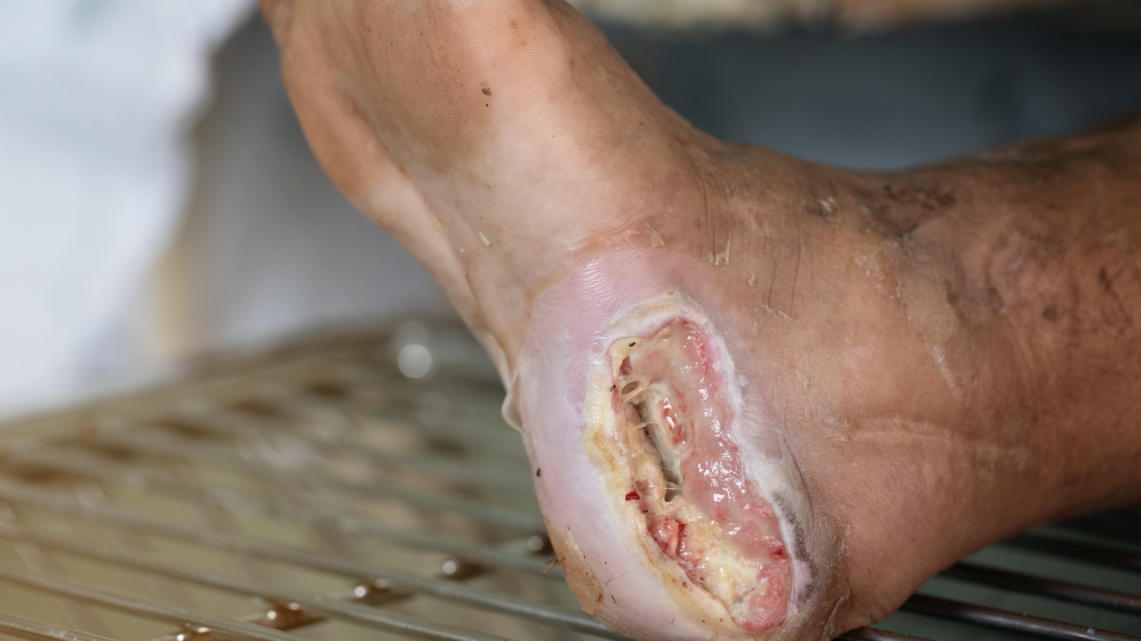 foot-bad-1280