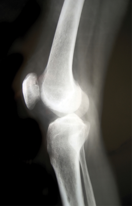 Bones-joint_xray.jpg