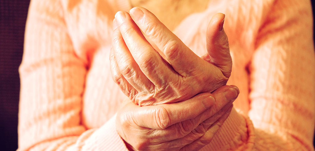 rheumatoid arthritis summary.jpg