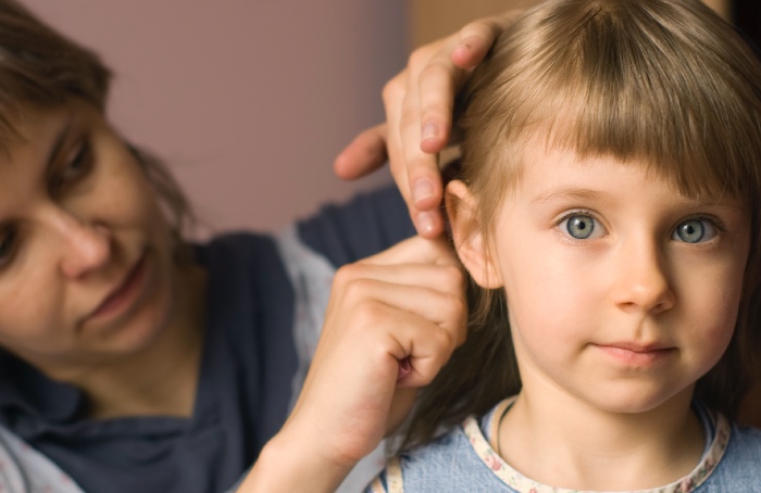Head lice .jpg