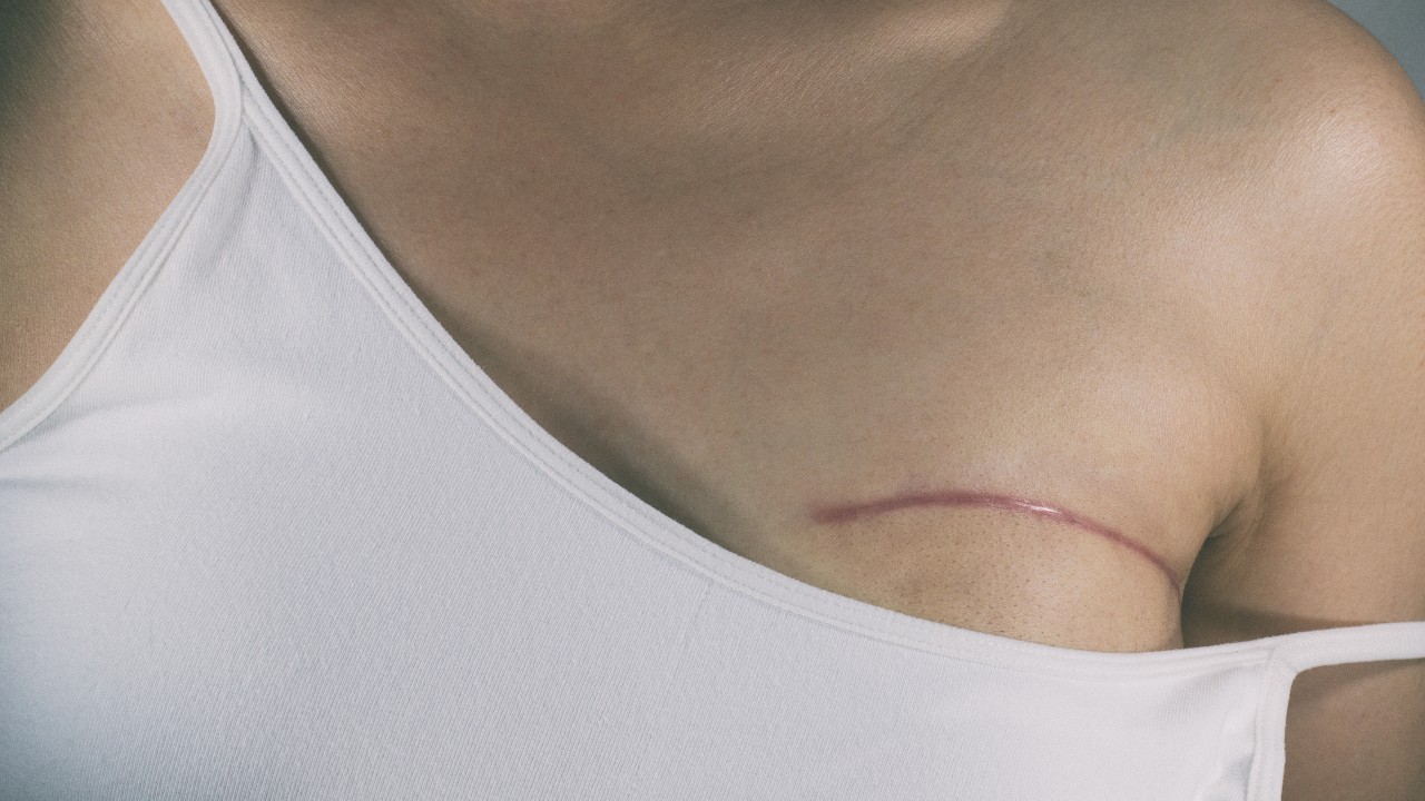 Breast cancer 1280.jpg
