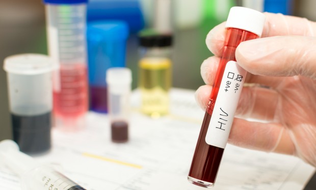 HIV 620.jpg