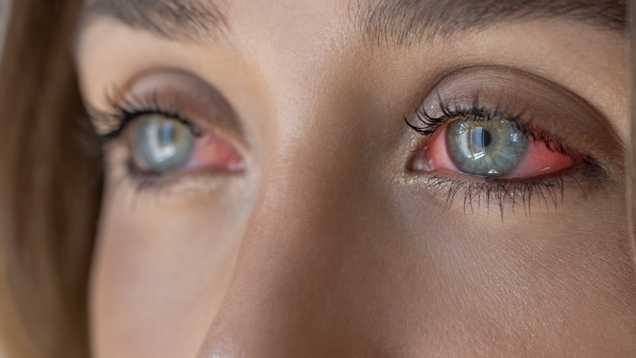 hayfever-2026-ed-new-1280