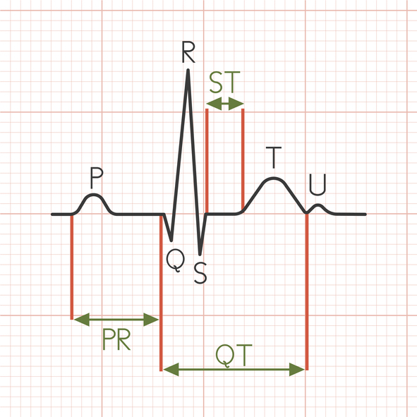 QT interval.jpg