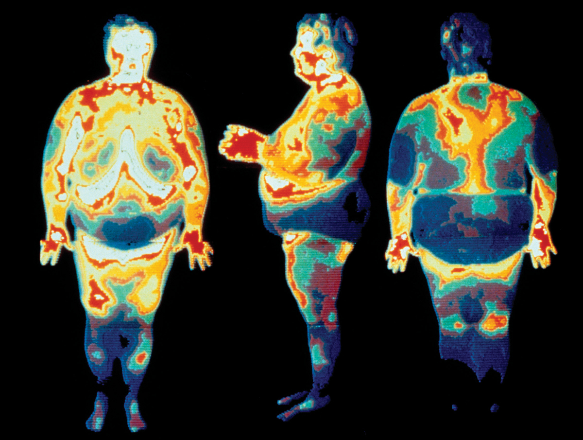 Fat lady scan.jpg