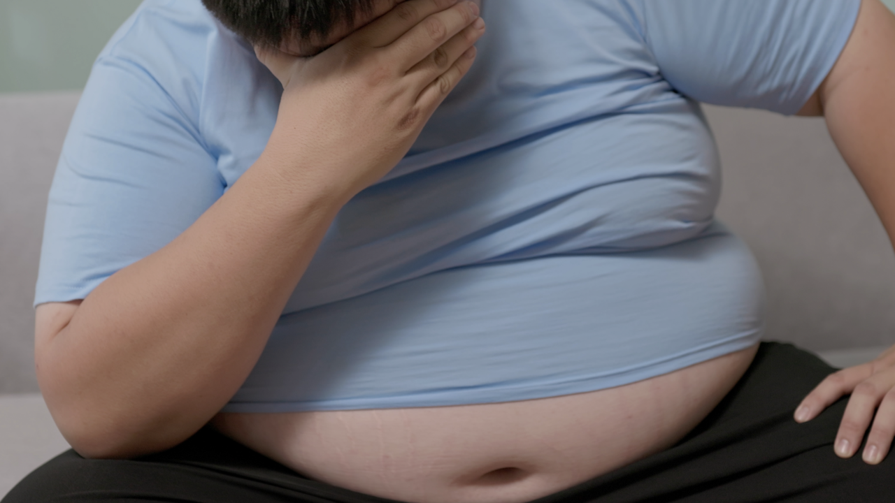 obesity-2026-1280