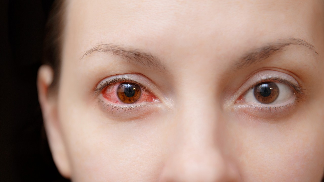 eye-care-1280
