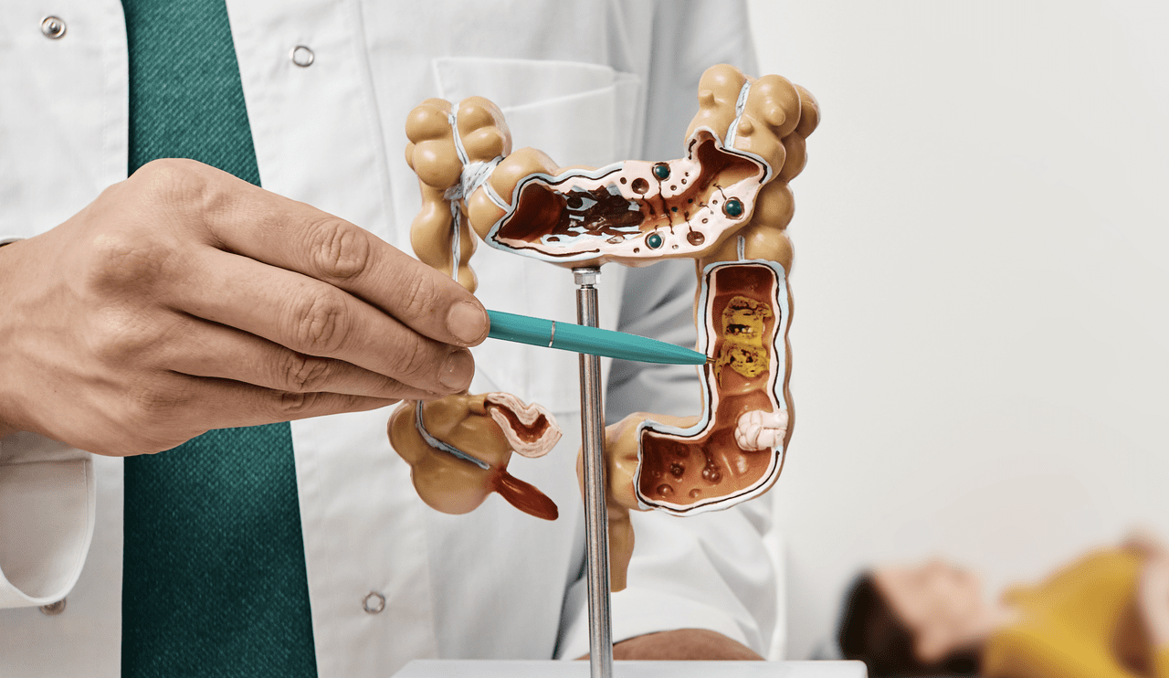 digestive-disorder-2024-1280