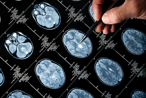 brain scans copy.jpg