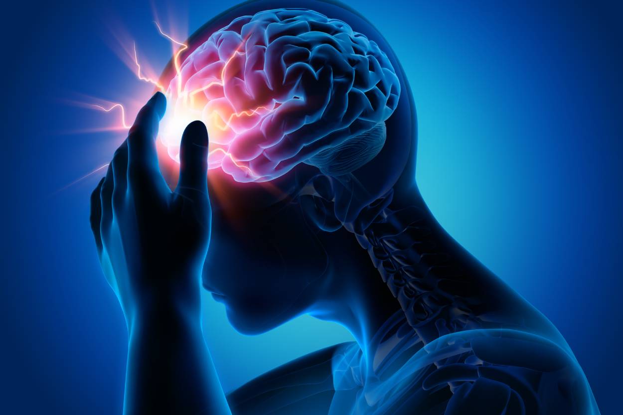 headache-concept2